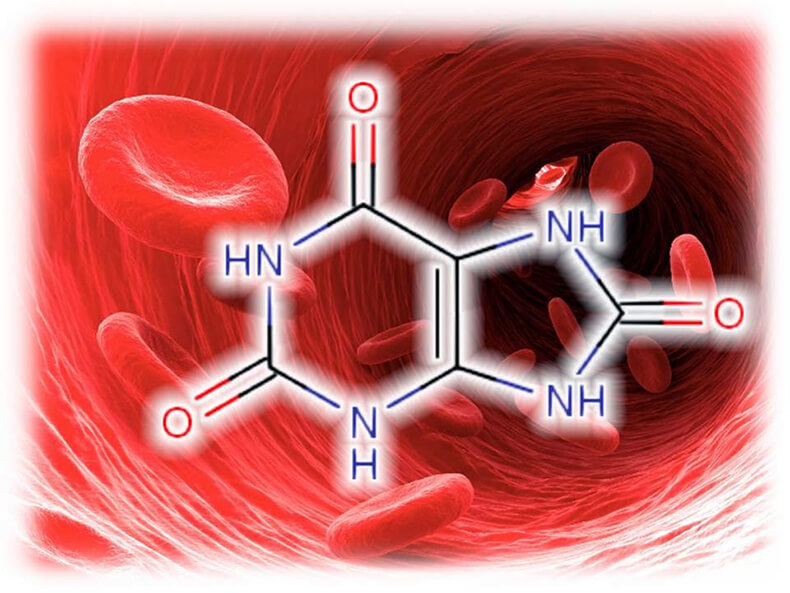 Мочевая кислота повышена: влияние на здоровье