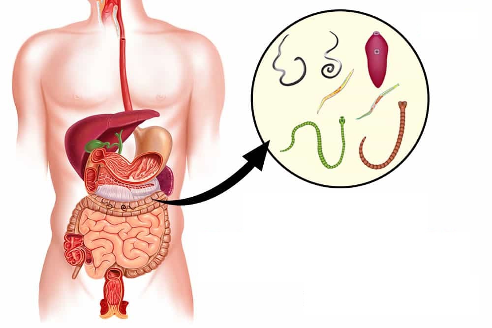 Как избавиться от паразитов: пошаговая инструкция