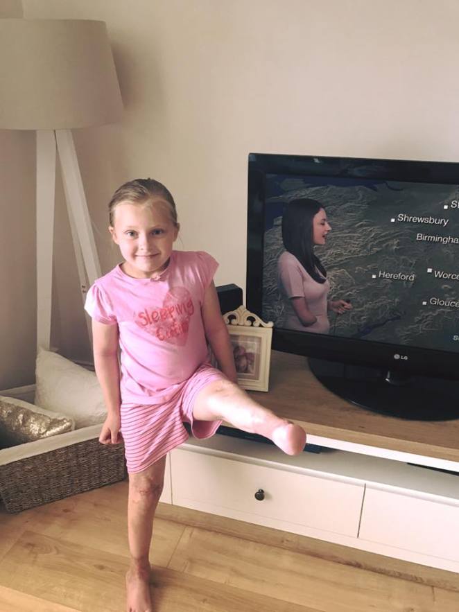 Синяки продолжали появляться по всему телу 7-летней девочки – когда её мать узнала ужасный диагноз, было уже поздно Синяки продолжали появляться по всему телу 7-летней девочки – когда её мать узнала ужасный диагноз, было уже поздно