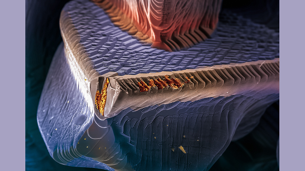 Лучшие снимки из коллекции научных фотографий Wellcome