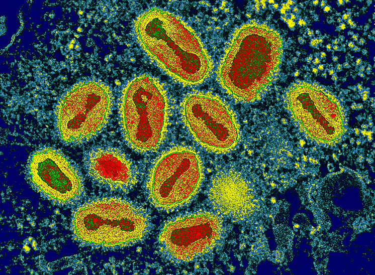 M0500567-Smallpox_viruses.jpg