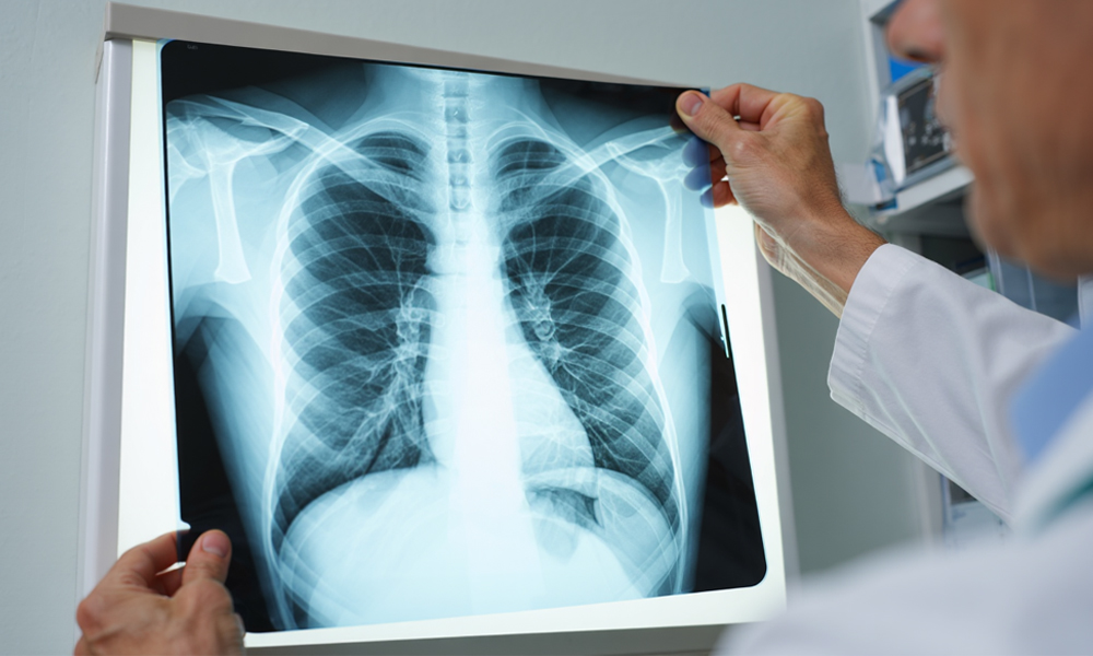 Врач развеяла мифы о рентгене и рассказала об обследованиях без риска облучения