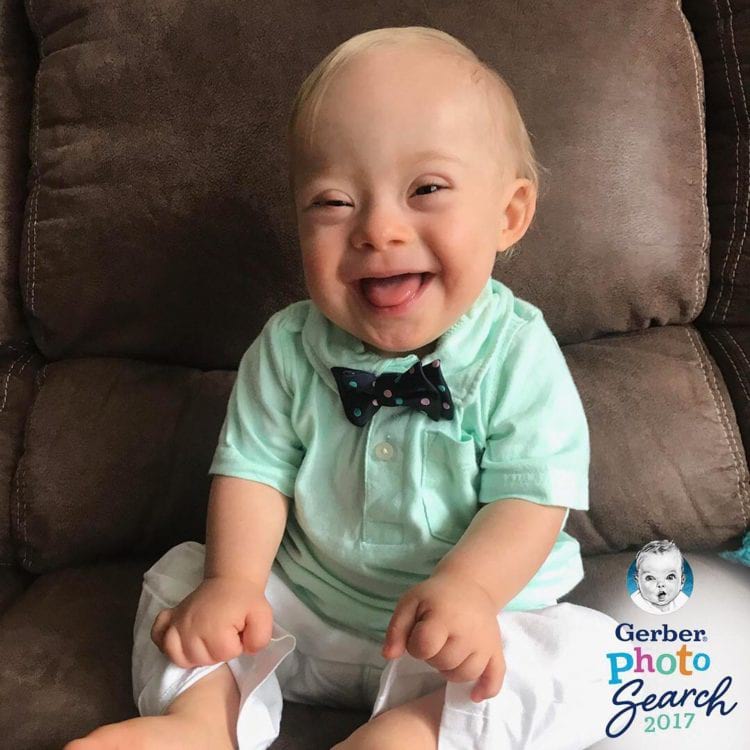 Малыш с синдромом Дауна победил в конкурсе фотографий Gerber Baby Малыш с синдромом Дауна победил в конкурсе фотографий Gerber Baby