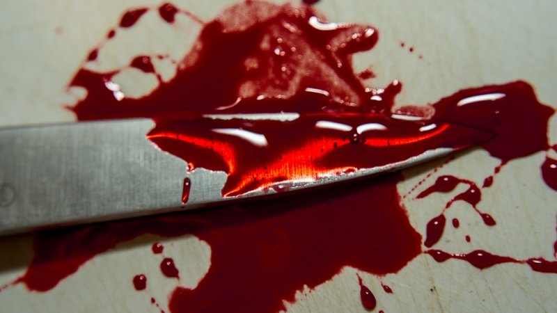Душевнобольной житель Северодвинска пытался зарезать брата кухонным ножом