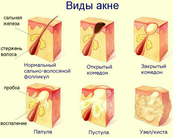 Смотри, что банановая кожура может сделать с твоей кожей! Эффективней средства я не встречала!