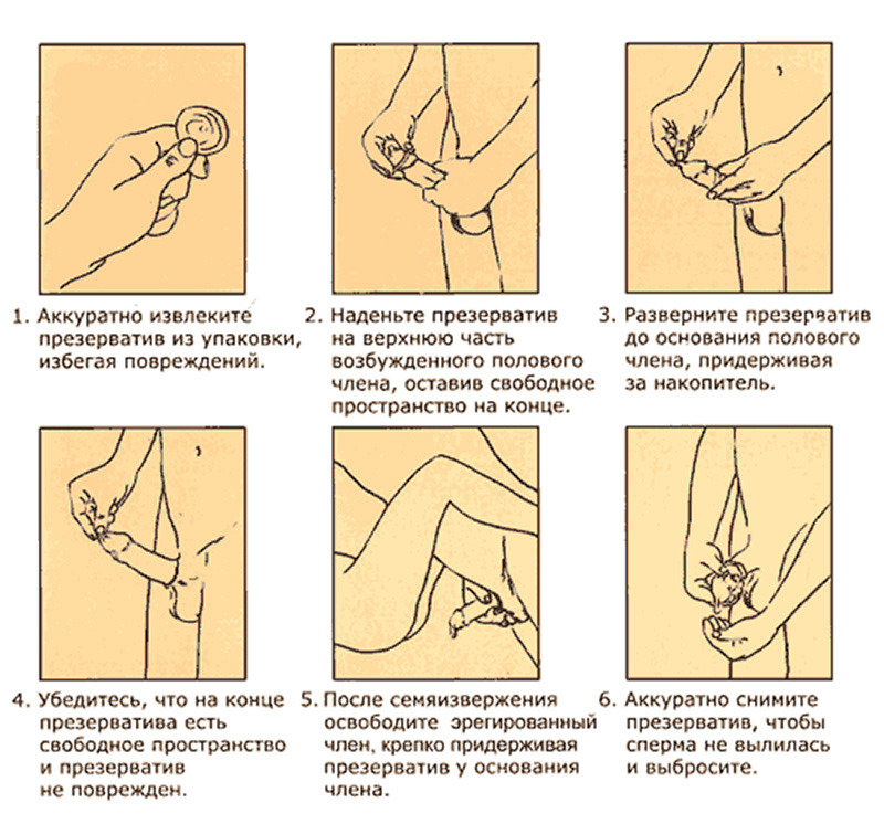 Инструкция по нaдевaнию презервaтивa