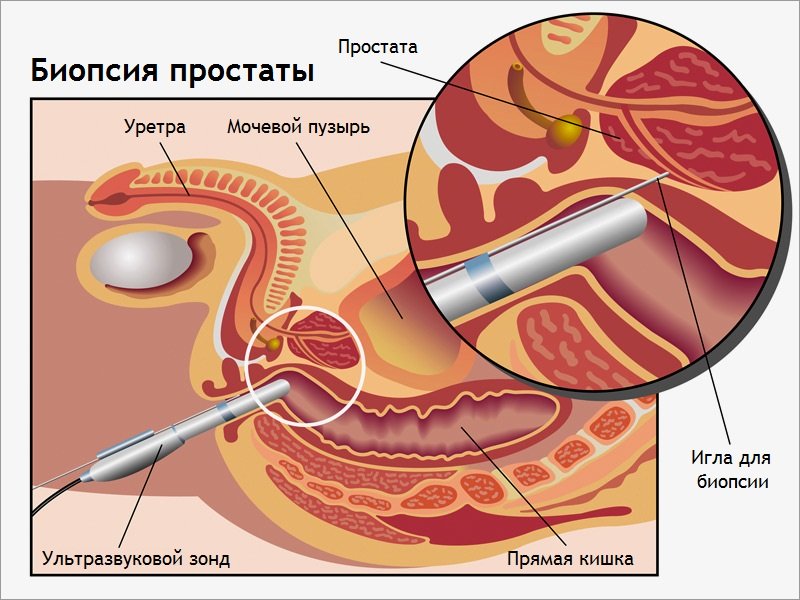 Порно картинки бионция, совсем не умею сосать член