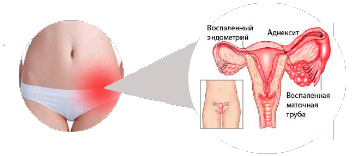 Причина боли под лопатками на спине