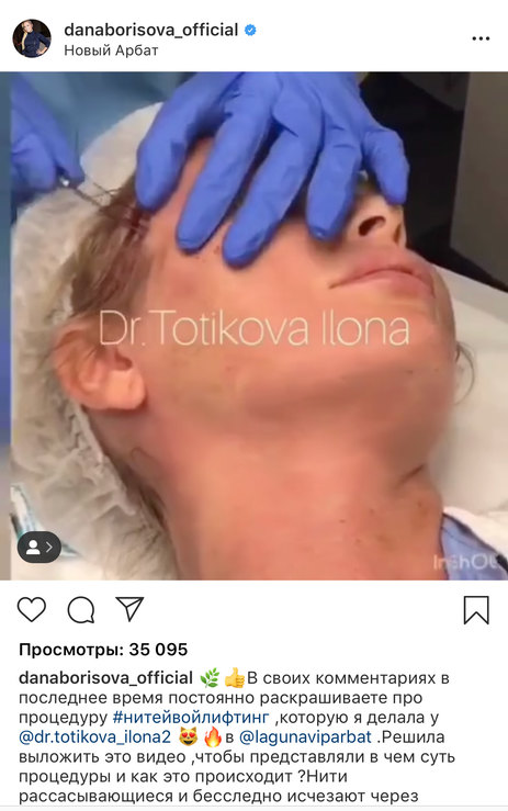 дана борисова пластик