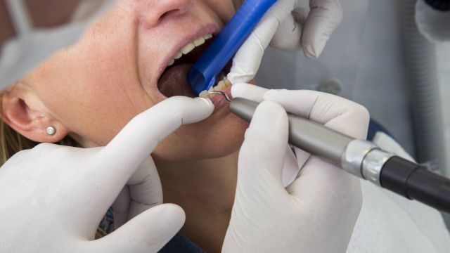Стоматологи назвали главные продукты – "разрушители" зубов