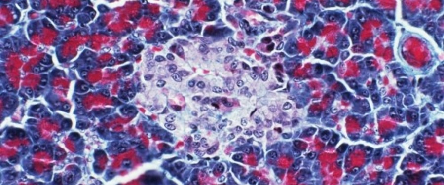 Ученые впервые создали зрелые клетки поджелудочной из стволовых Ученые впервые создали зрелые клетки поджелудочной из стволовых