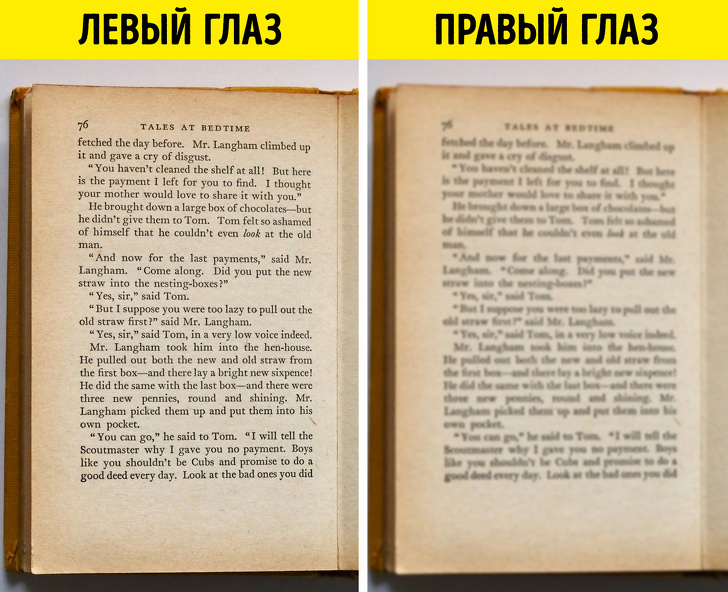 Первые признаки рассеянного склероза, о которых стоит знать не только людям в возрасте