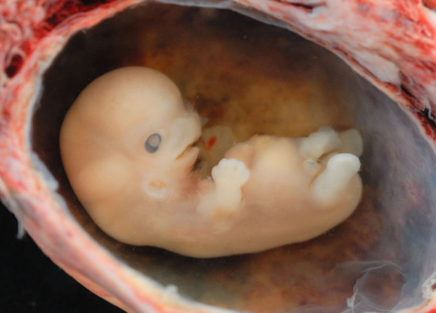 У эмбрионов человека обнаружили признаки старения