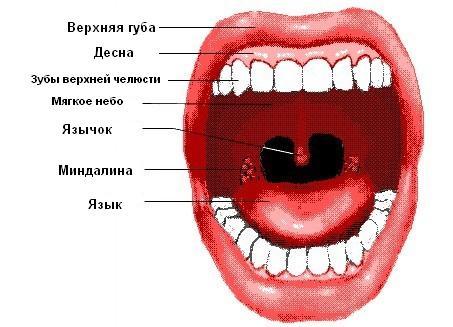 Как лечить белые комочки в горле в домашних условиях