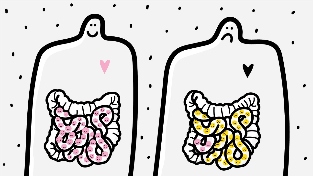 bowel_2