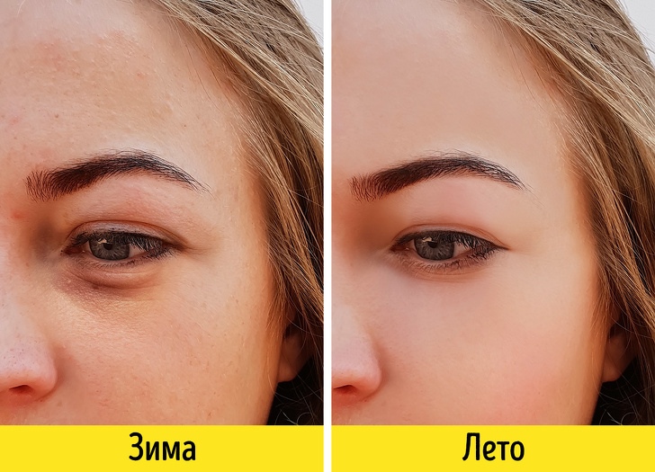7 зимних факторов, из-за которых мы выглядим старше 7 зимних факторов, из-за которых мы выглядим старше
