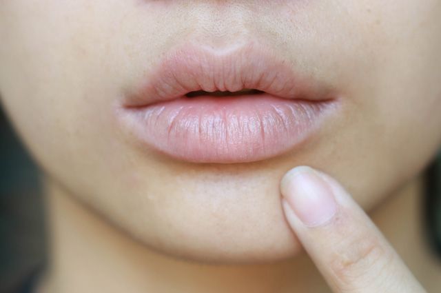 Почему трескаются губы