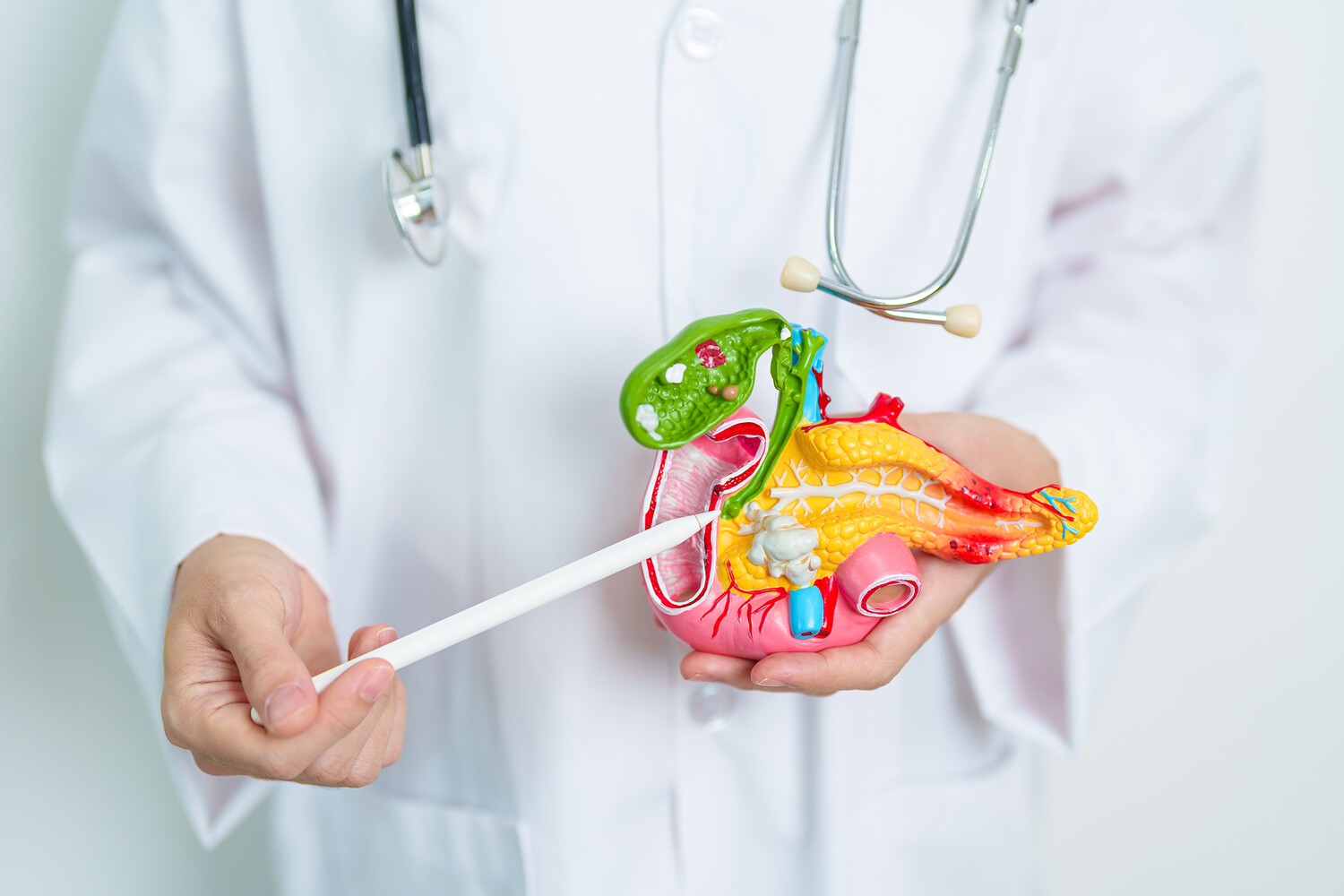 Врачи выявили первый сигнал рака поджелудочной: Возникает за два года до болезни