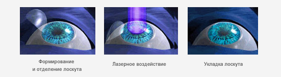 ip_lay