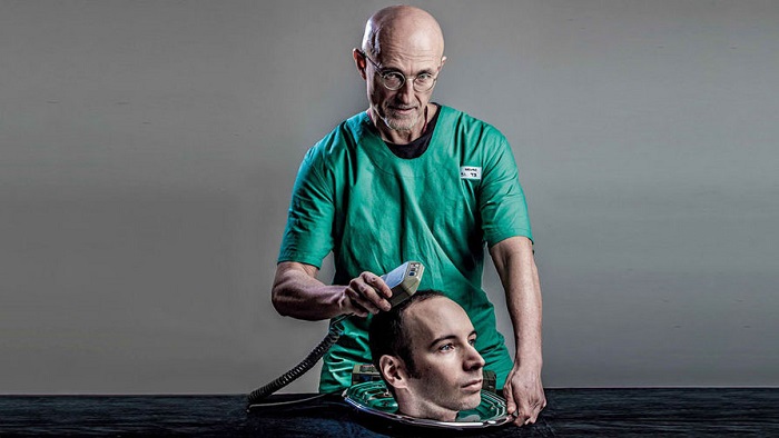 В Китае была проведена первая успешная трансплантация головы.