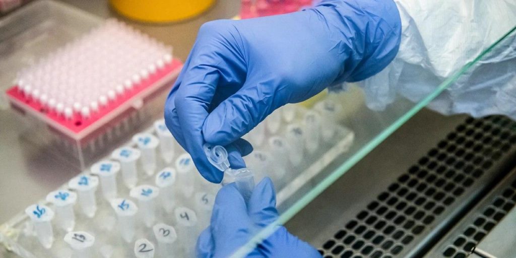 В Москве частные лаборатории будут исследовать тесты на COVID-19