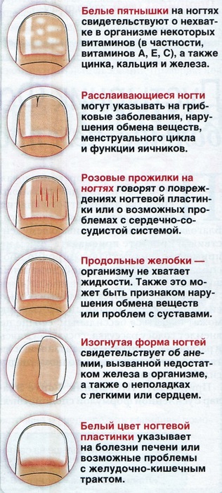 Ногти при разных заболеваниях Ногти при разных заболеваниях