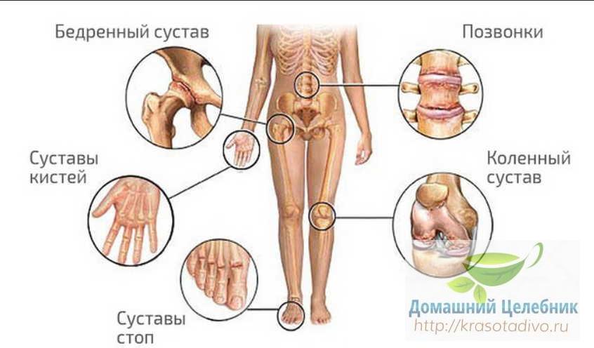Лечение ревматизма народными методами: спасительные травы придут на помощь Лечение ревматизма народными методами: спасительные травы придут на помощь