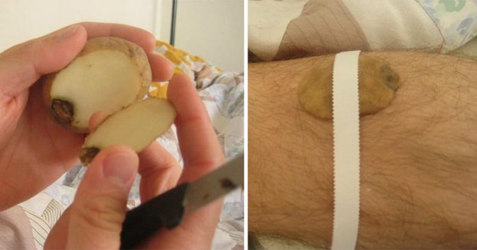 11-bizarre-home-remedies-grandparents-used-actually-work