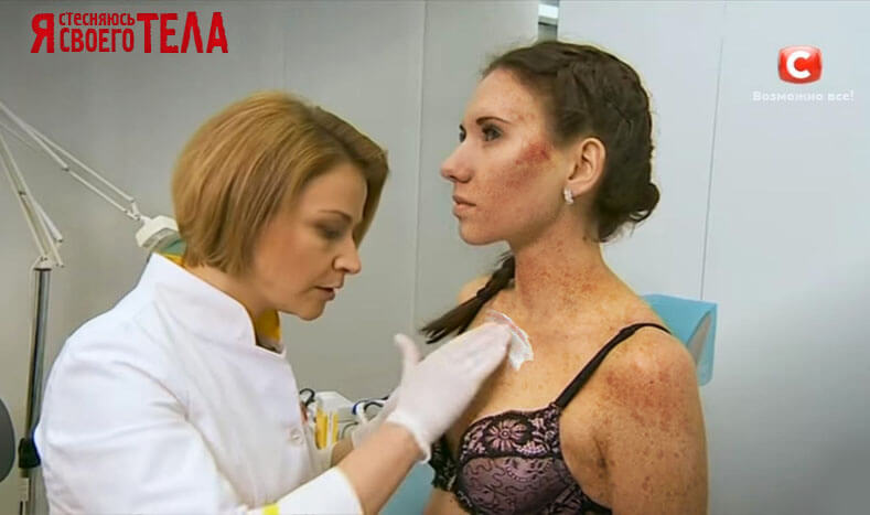 Забудьте о них навсегда! Быстрый способ избавиться от пигментных пятен на лице и руках в домашних условиях. Забудьте о них навсегда! Быстрый способ избавиться от пигментных пятен на лице и руках в домашних условиях.