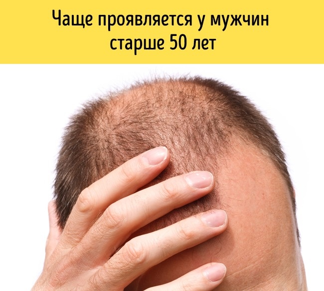 За месяц до сердечного приступа организм начнет вас предупреждать. 8 главных симптомов