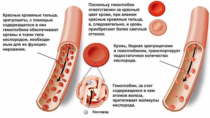 железодефицитная анемия симптомы и лечение