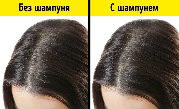 Продукты, из-за которых волосы теряют блеск и выпадают