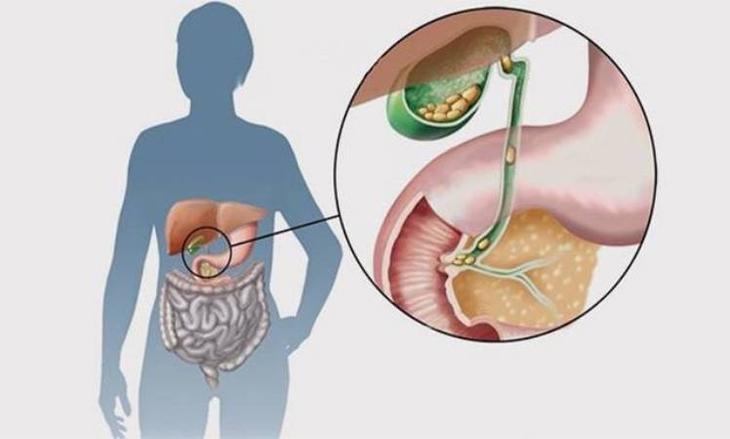 Ð¢ÐžÐŸ-9 Ð½ÐÑ‚ÑƒÑ€ÐÐÑŒÐ½Ñ‹Ñ… ÑÑ€ÐÐ´ÑÑ‚Ð² Ð´ÐÑ ÐÐÑ‡ÐÐ½Ð¸Ñ ÐÐÐÑ‡Ð½Ð¾ÐºÐÐ¼ÐÐ½Ð½Ð¾Ð¹ ÐÐ¾ÐÐÐÐ½Ð¸ 