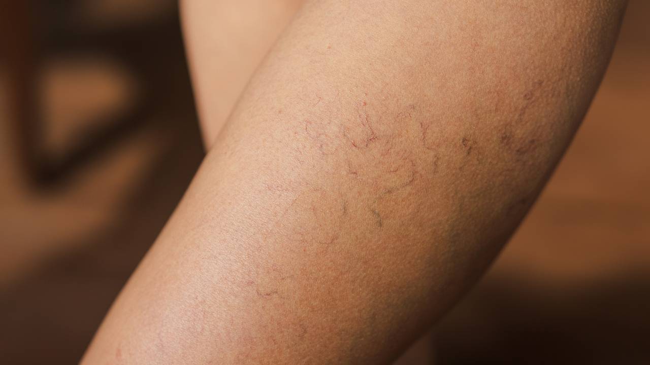 Назван единственный способ продлить здоровье сосудов