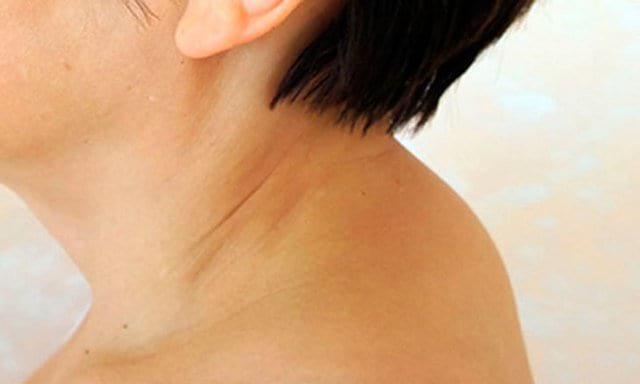 ÐоÑоÑниковÐÑ ÐонРÑпинÑ