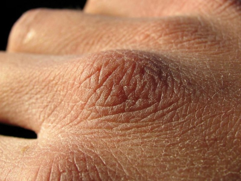 5 удивительно простых способов помочь сухой коже рук