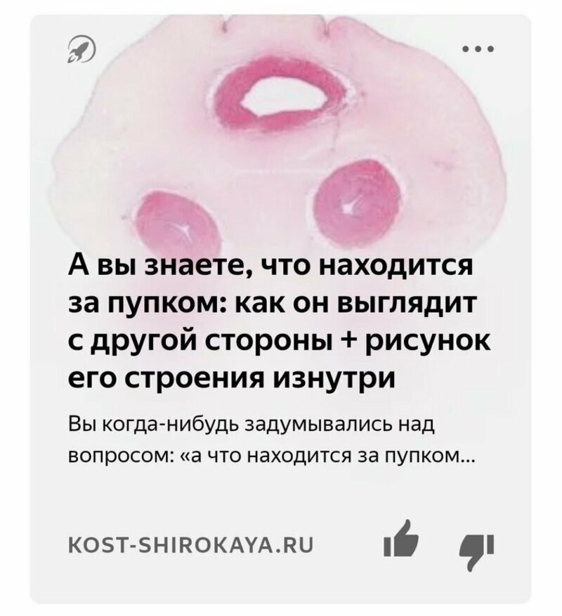 Яндекс.Дзен фигни не посоветует Яндекс.Дзен фигни не посоветует
(18 фото)