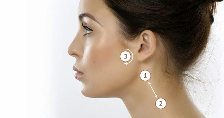    excessive hair growth in females