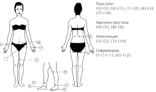 простатит, аденома простаты, импотенция, сперматорея.