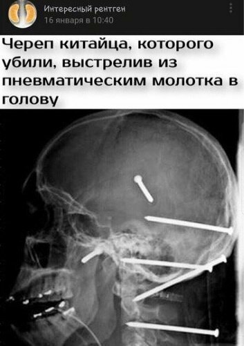 Фейки о коронавирусе - самые опасные! Фейки о коронавирусе - самые опасные!