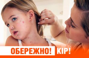 Украинская зараза убивает десятки людей от Галиции до Киева и Одессы. Невиданная эпидемия: тысячи заболевших, множество погибших, угроза подступает к российскому Крыму Украинская зараза убивает десятки людей от Галиции до Киева и Одессы. Невиданная эпидемия: тысячи заболевших, множество погибших, угроза подступает к российскому Крыму