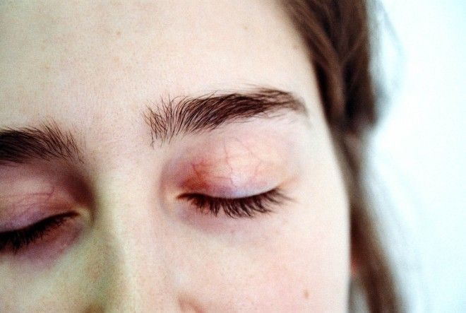 16 симптомом, на которые мы не обращаем внимания, а надо бы симптомы болезней симптомы на которые мы не обращаем внимания