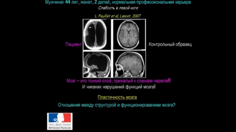 виндаль23-2 Как устроен мозг