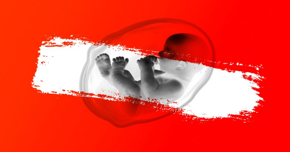 ❌ Первые во всем мире: 5 исторических фактов об абортах в СССР