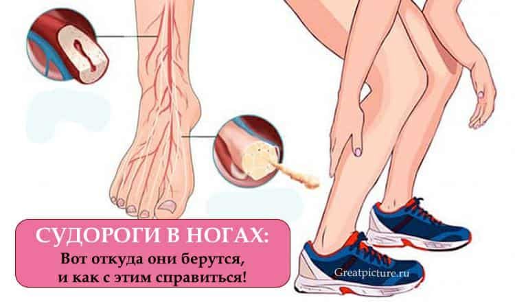 Судороги в ногах: Вот откуда они берутся, и как с этим справиться