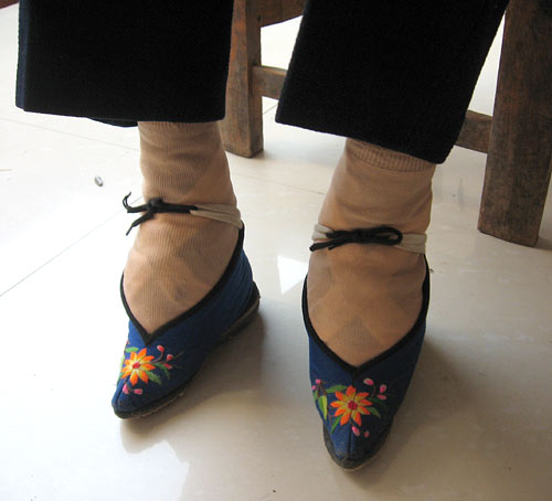 Китайские "лотосовые ножки" -"lily feet"- и ужасающие подробности этого обычая Китайские "лотосовые ножки" -"lily feet"- и ужасающие подробности этого обычая