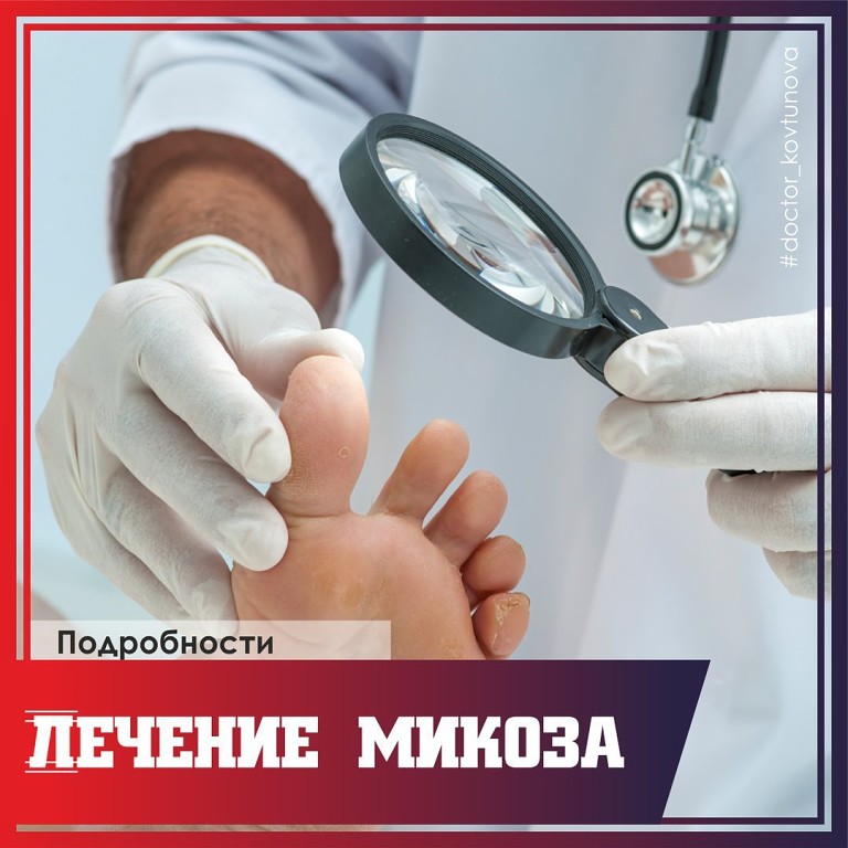Лечение микоза