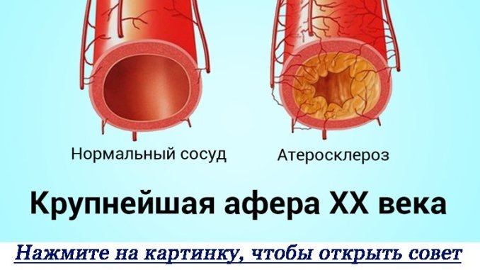 domashnie-tsveti-na-kotorih-net-allergii-foto-2-27