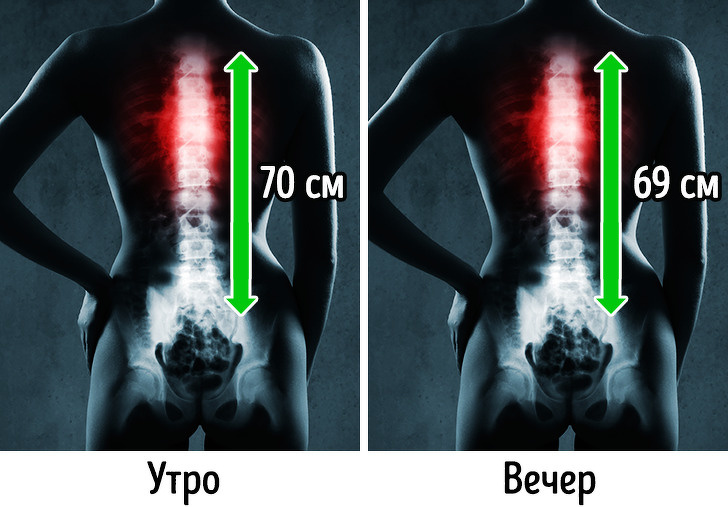 14 фактов о нашем теле, в которые верится с трудом (Да, сердце может изменить свою форму)