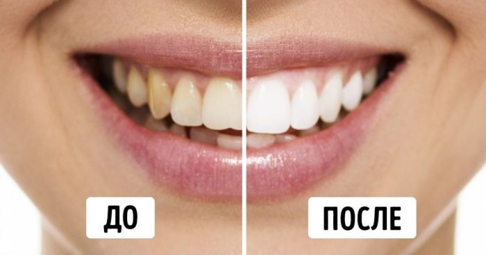 Да здравствует прекрасная улыбка! \ Фото: pinterest.at. Да здравствует прекрасная улыбка! \ Фото: pinterest.at.